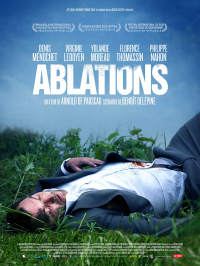 Ablations